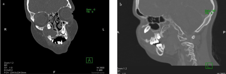 Figure 1. a, b