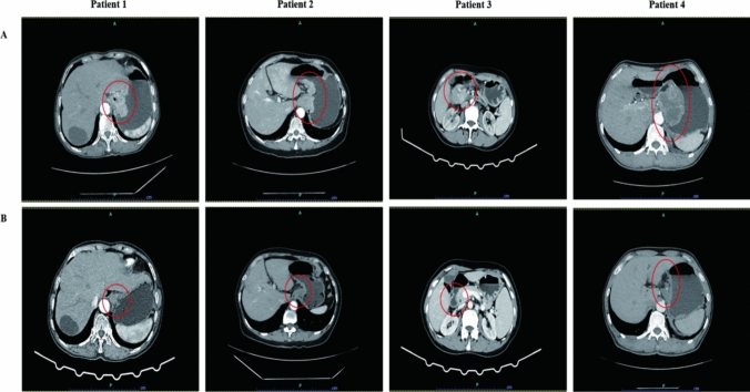 Fig. 2