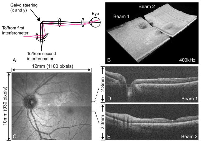 Fig. 11