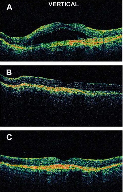 Figure 15