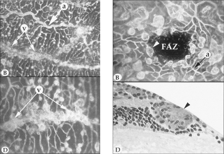 Figure 18