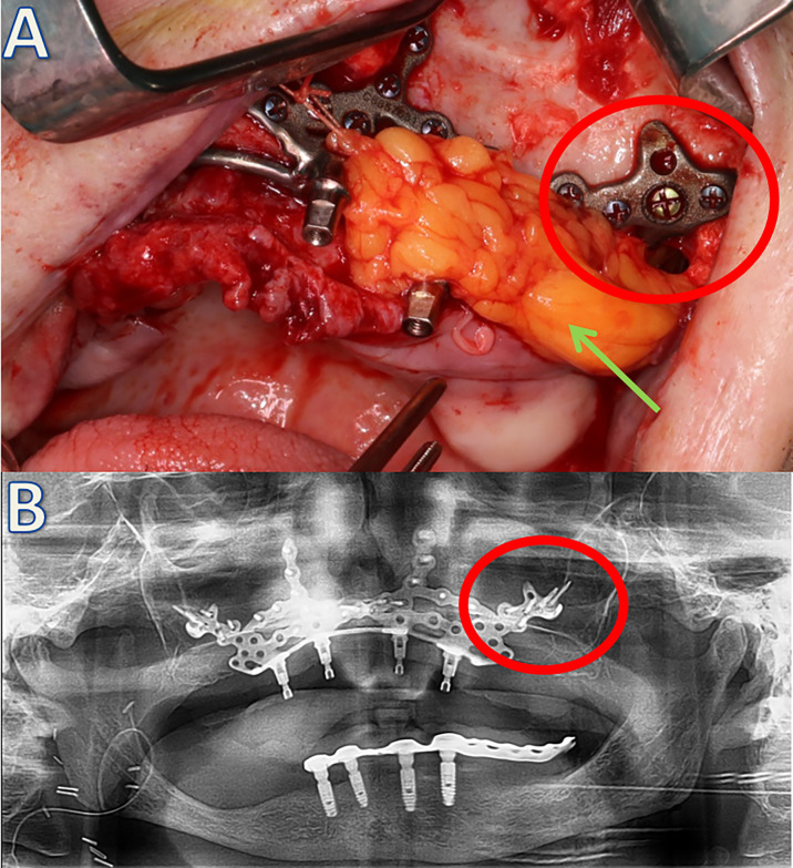 Figure 3
