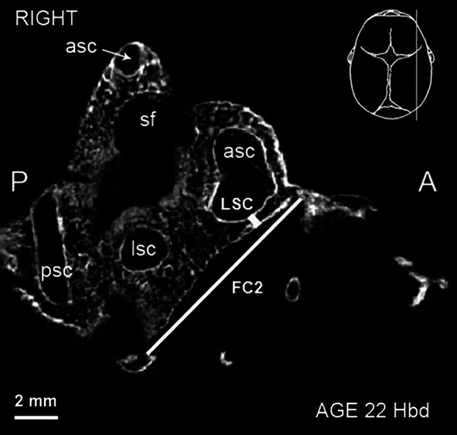 Fig. 2