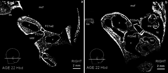 Fig. 3