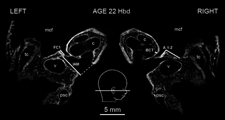 Fig. 1