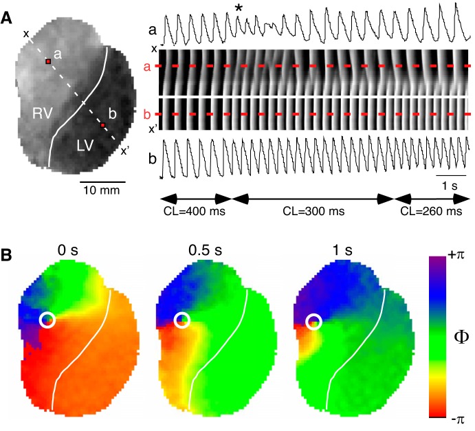 Fig. 14.