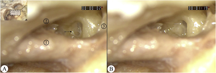 Fig. 3