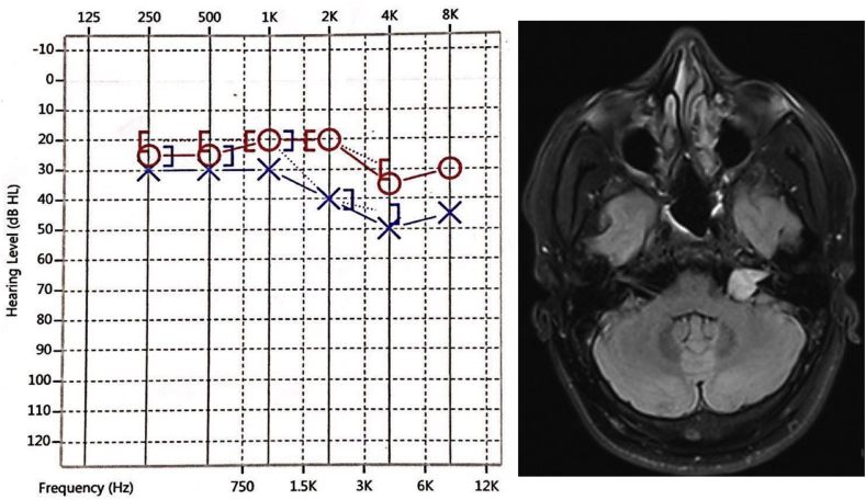 Fig. 1