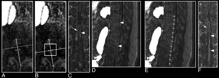 Fig 6.