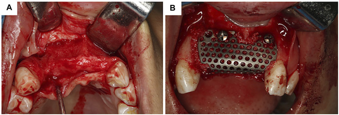 FIGURE 4