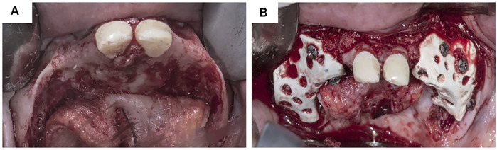 FIGURE 6