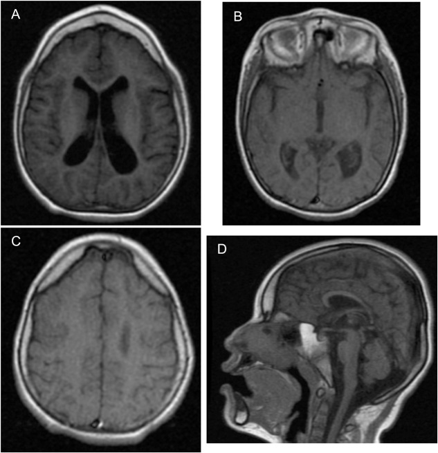 FIGURE 2