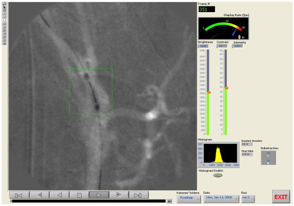 Figure 11