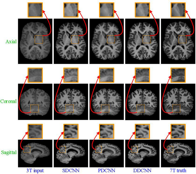 Figure 14: