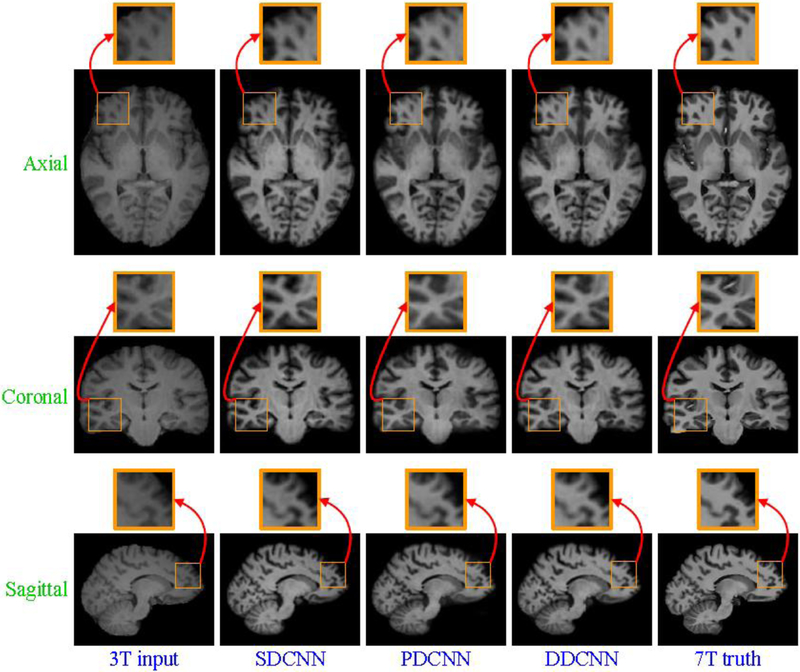 Figure 13: