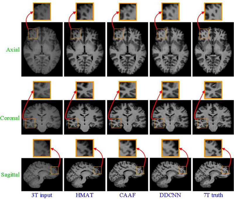 Figure 7: