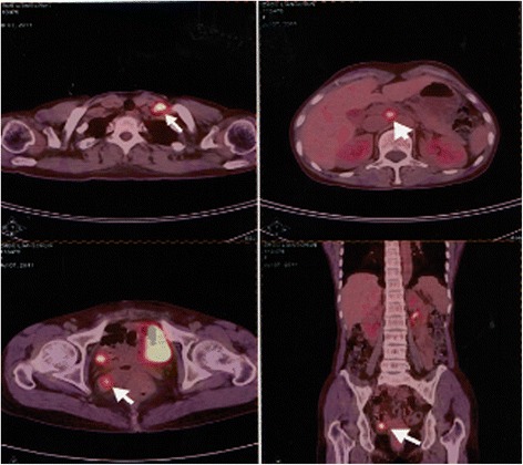 Fig. 3