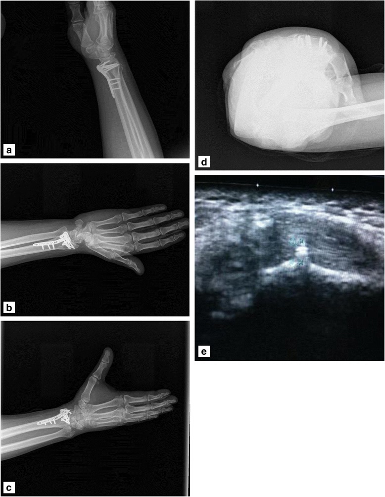 Fig. 2