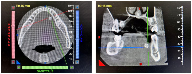 Figure 9