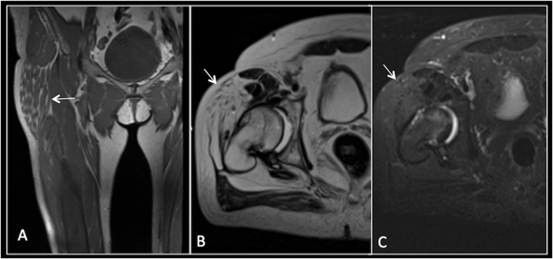 Fig. 10