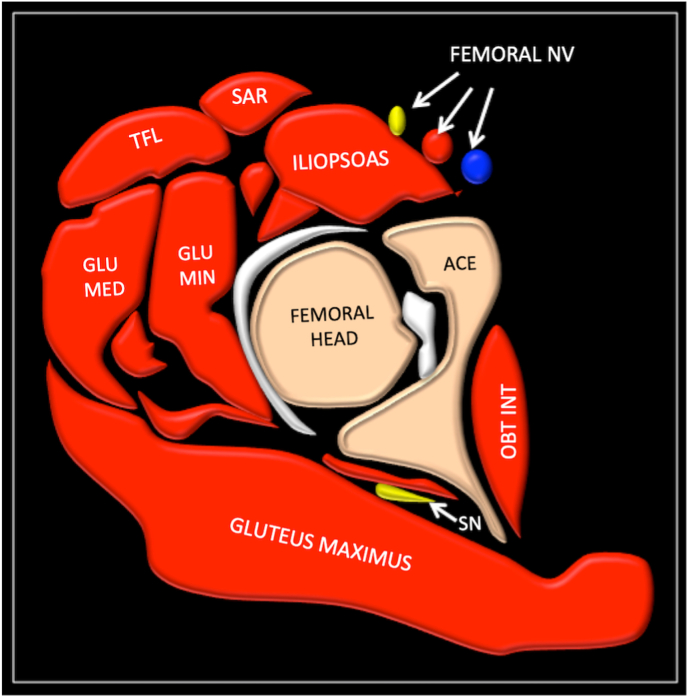 Isolated pathologies of Tensor Fasciae Latae: Retrospective cohort ...