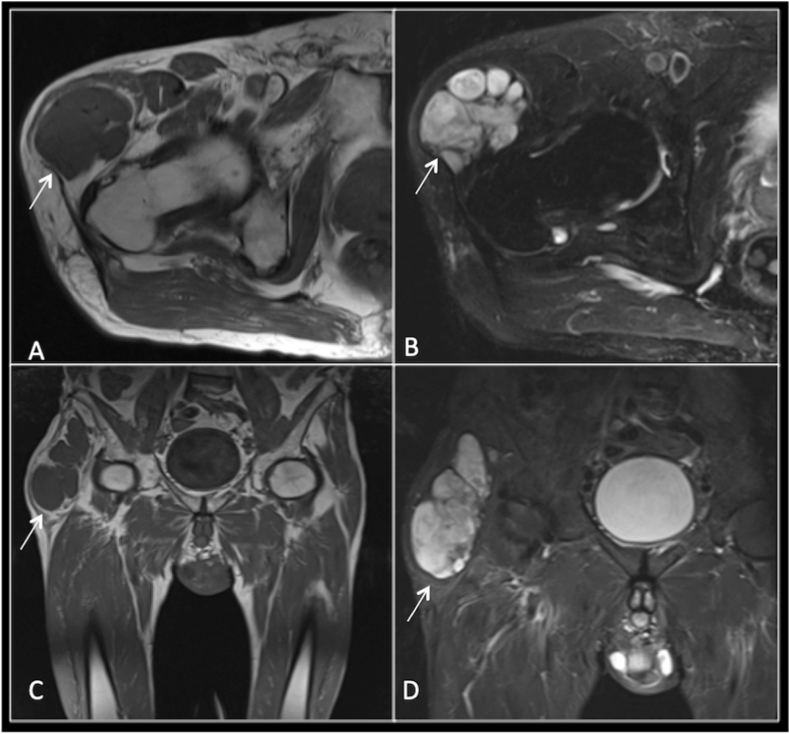 Fig. 4