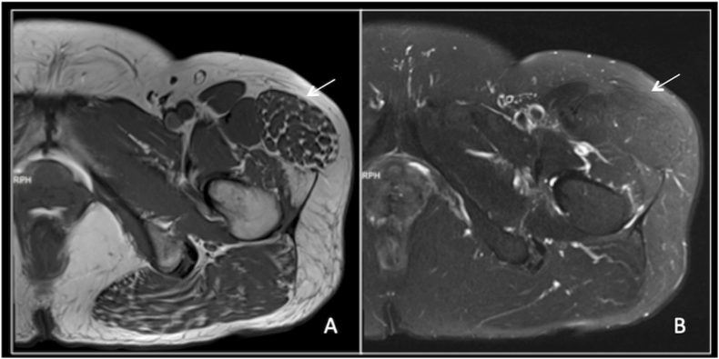 Fig. 11