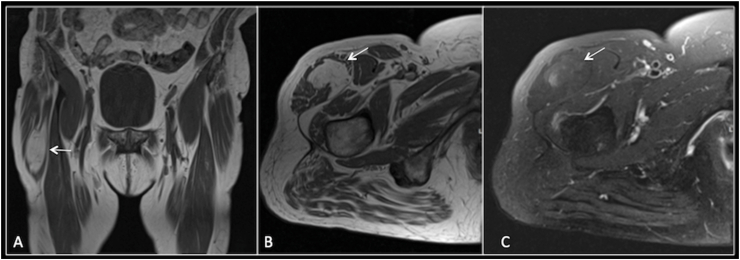 Fig. 6