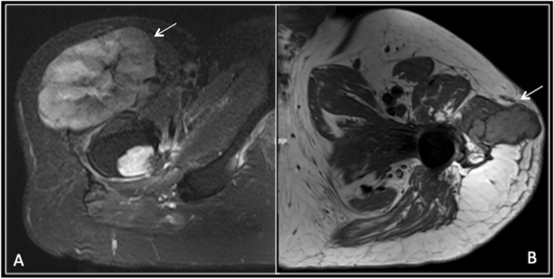 Fig. 9