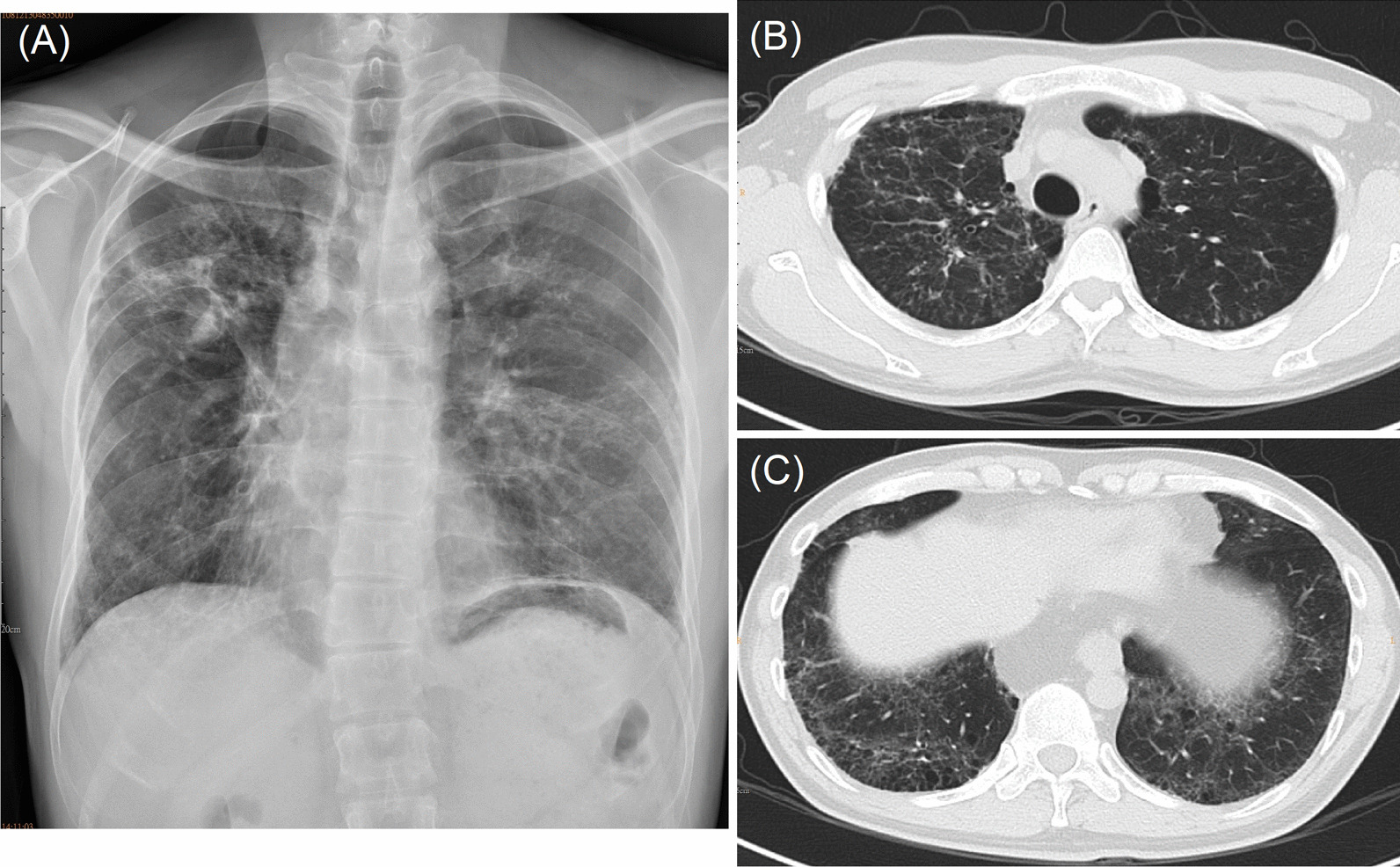 Fig. 1