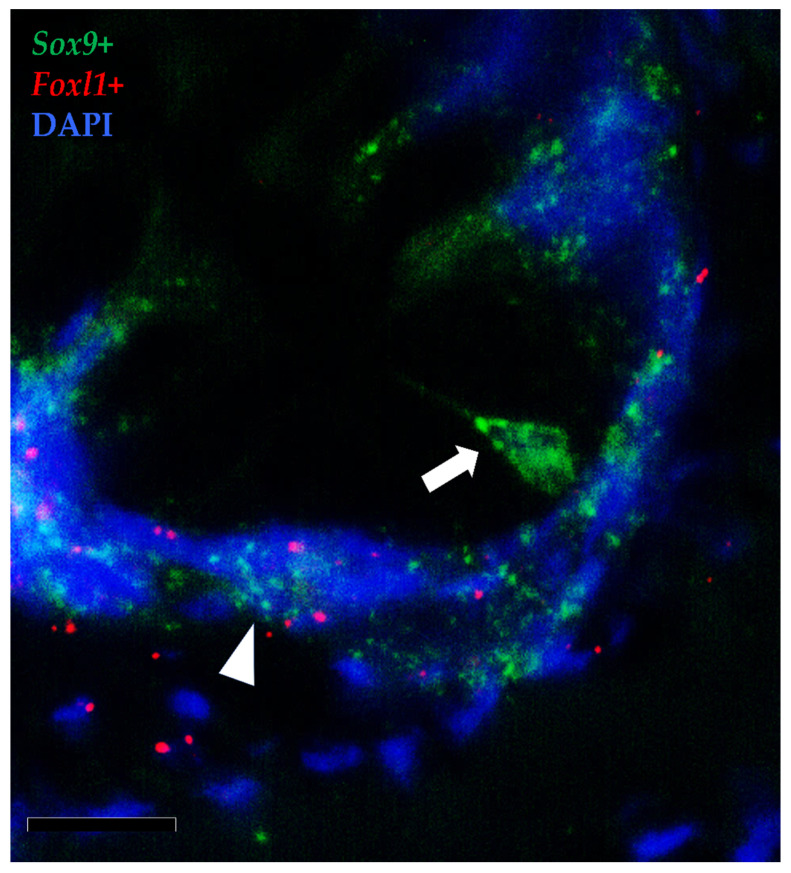 Figure 14