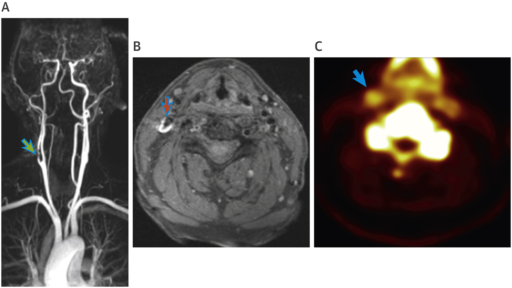 FIGURE 2