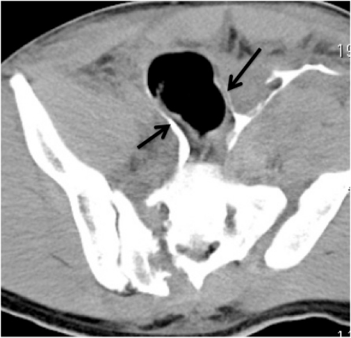 Figure 5c: