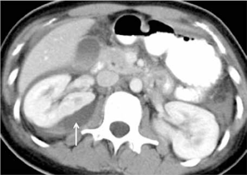 Figure 4c: