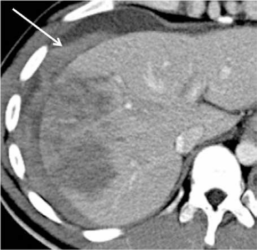 Figure 1b: