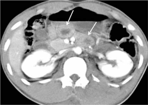 Figure 7b: