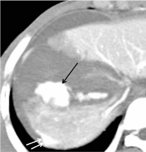 Figure 1c: