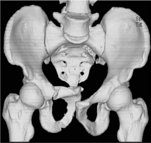 Figure 9a: