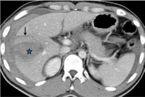 Figure 3b: