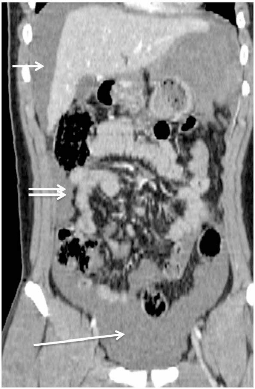 Figure 1a: