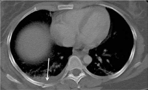 Figure 11b: