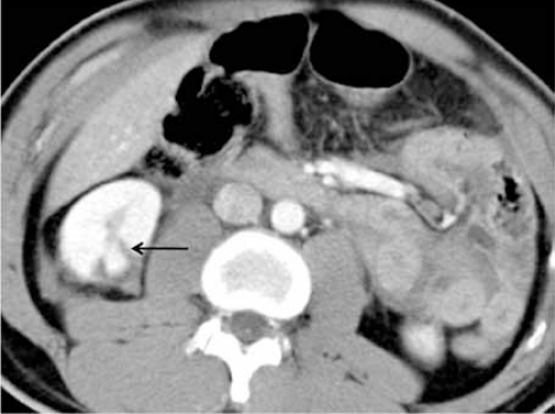 Figure 4b: