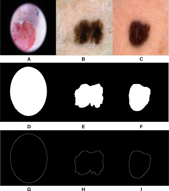 Figure 18