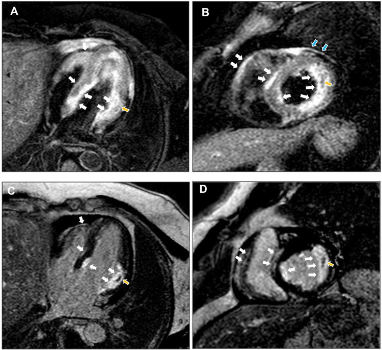 Fig. 4