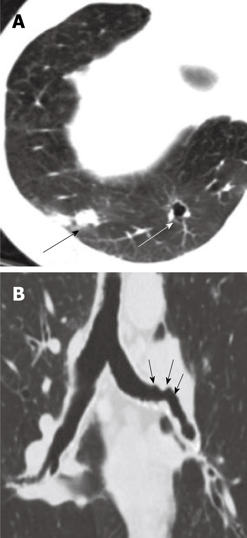 Figure 18