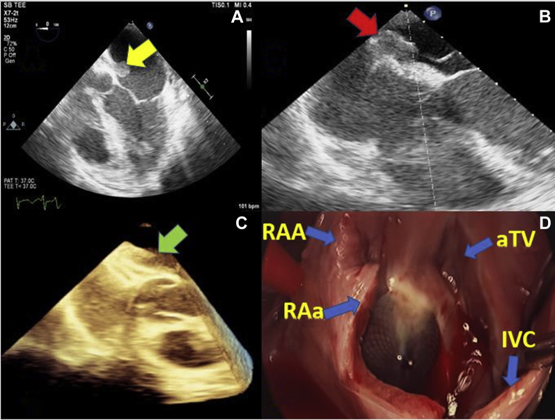 Figure 1