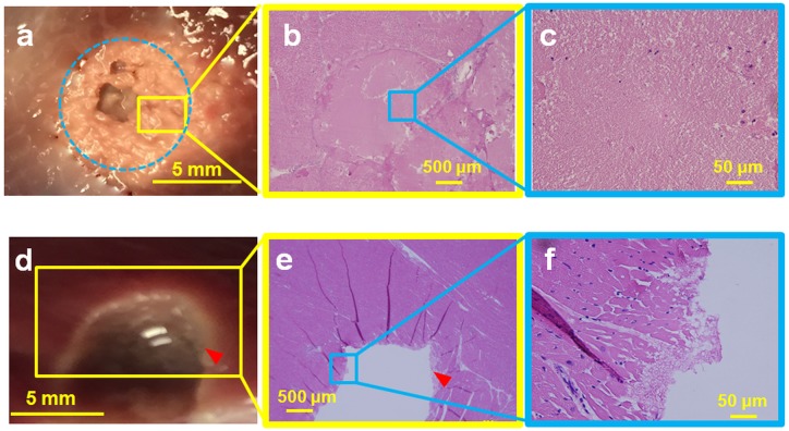 Fig 10