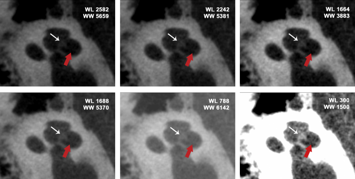 Fig. 1