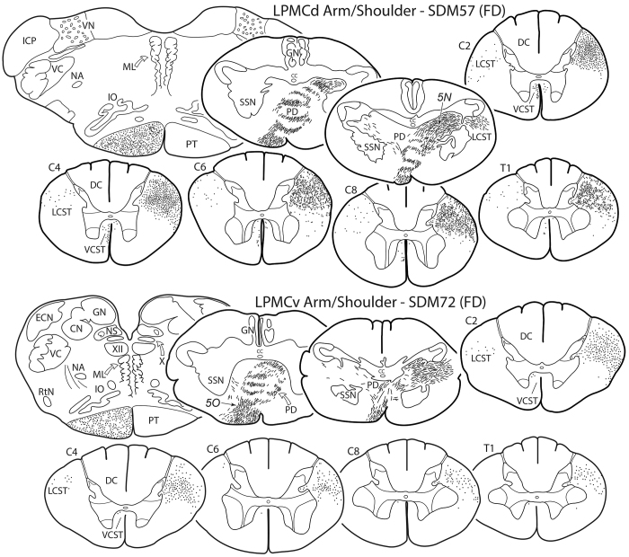 Lack of somatotopy among corticospinal tract fibers passing through the ...