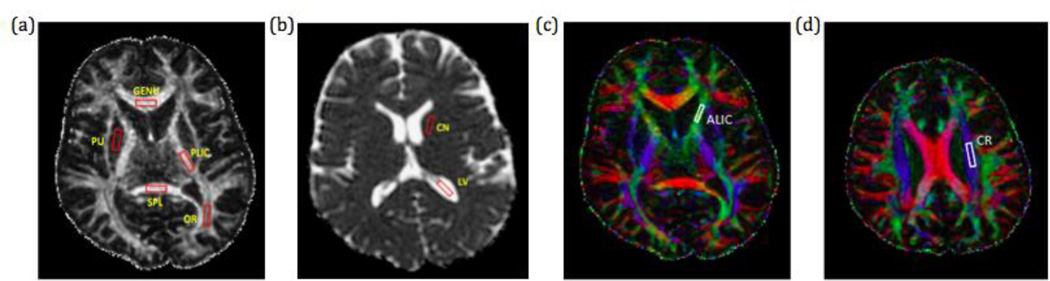 Fig 1